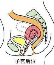 Posterior úter