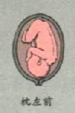 Al davant, esquerra Costat posterior