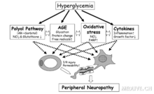 La neuropatia perifèrica diabètica