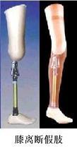 Pròtesis de desarticulació del genoll