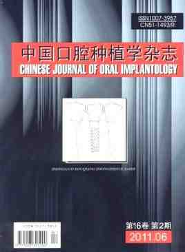Diari Xinès d'Implantologia Oral
