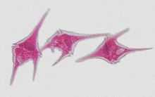 Costatum